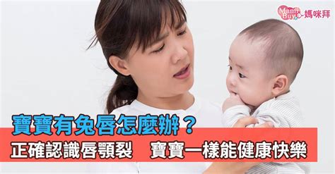 嚴重兔唇|如何照顧兔唇寶寶？兔唇原因為何？一次看懂兔唇定義。